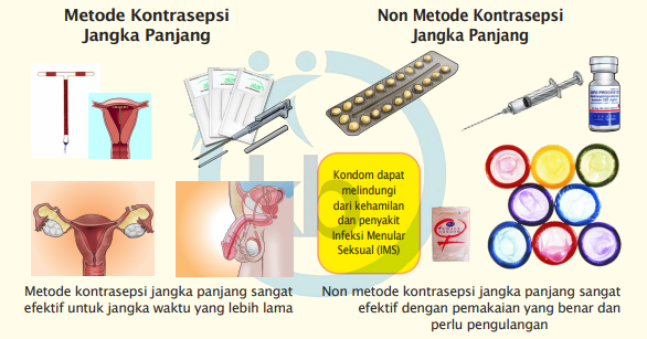 Pelayanan kb gratis